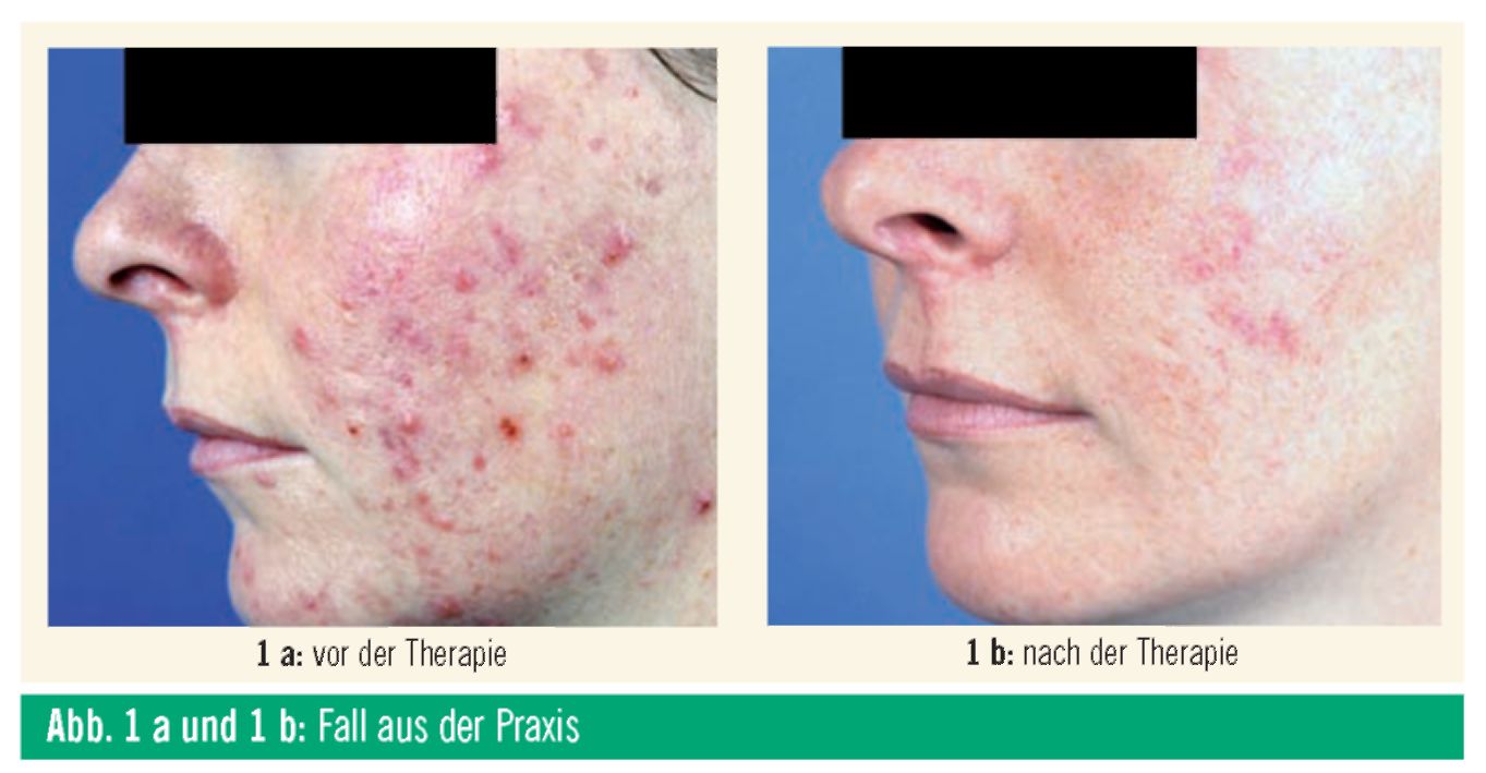 Dass es besser ist, wenn bei dir auf der Person die Pigmentflecke zu machen