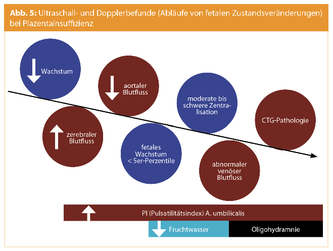 Schwangerschaftsmonitoring Ultraschall Und Fruhgeburt Medmedia