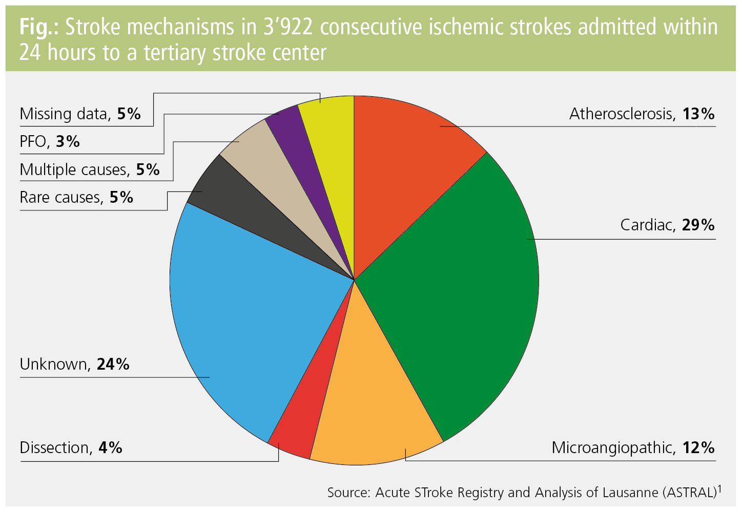 Rare causes of stroke – an overview | MedMedia Rare causes of stroke – an overview | MedMedia
