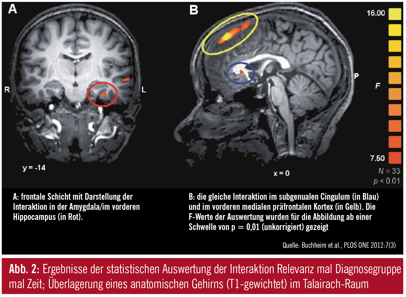 Neuropsychoanalyse Ein Exemplarischer Uberblick Medmedia