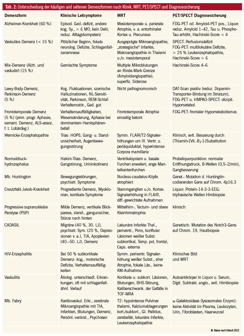 Bildgebung Bei Demenzerkrankungen Medmedia