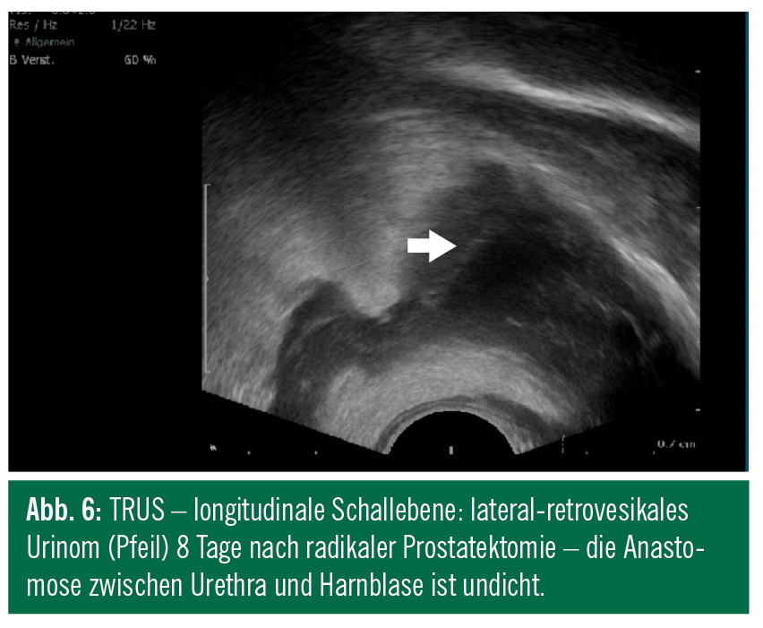tastbefund nicht suspekt
