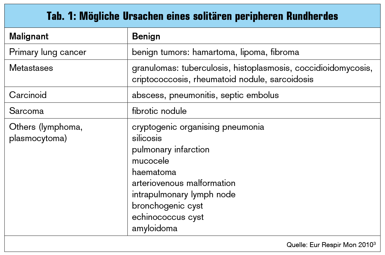 Der periphere Lungenrundherd Abwarten oder Abklären die Frage an den
