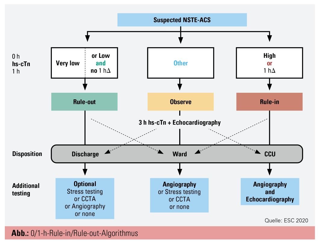 ESC Guidelines 2020 | „Non ST Segment Elevation Acute ESC Guidelines 2020 | „Non ST Segment Elevation Acute